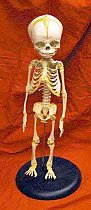 Skeleton Of Baby Mounted On Stand Cast