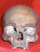 Human Skull