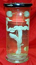 Dissected Genito-Urinary System Preserved In Glass Jar