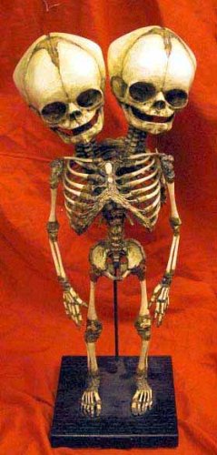 Antique Style Model Of Two Headed Baby