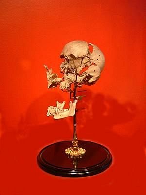 Disarticulated Skull