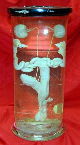 Dissected Genito-Urinary System Preserved In Glass Jar