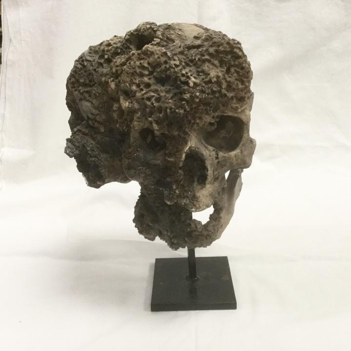 Elephant Man Skull Model | CURIOUS SCIENCE