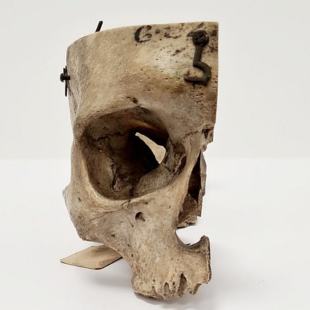 Partial Human Skull