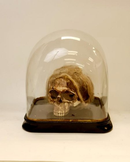 Composite Human Skull Under Glass Dome