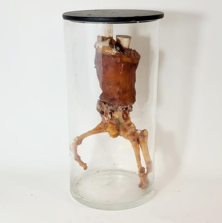 Severed Hand Portion In Glass Jar